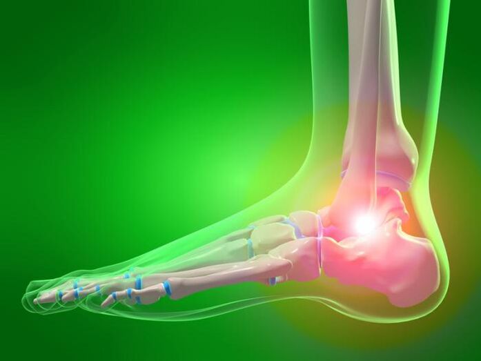 ankle joint inflammation with osteoarthritis