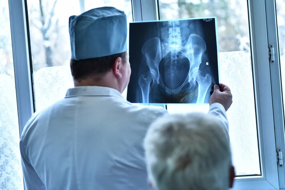 The doctor looks at the photo of a hip joint with osteoarthritis